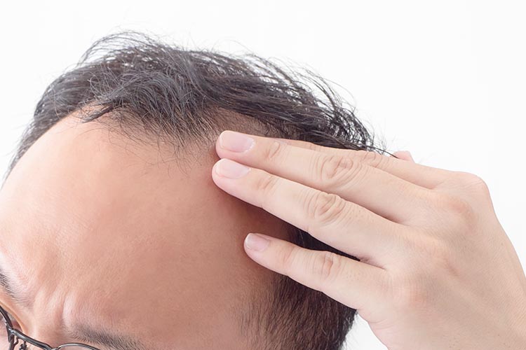 皮膚良性腫瘍とは