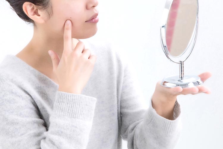 皮膚良性腫瘍とは